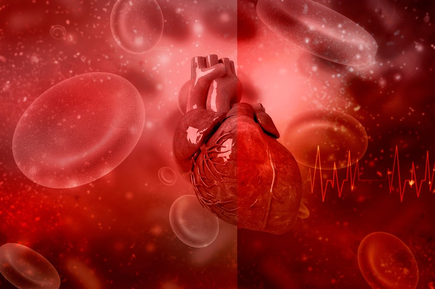 Jaka alergijska reakcija dovodi do spazma, tromboze ili oba, usled čega dolazi do zapušenja koronarnih arterija i infarkta