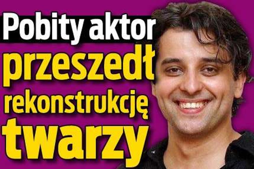 Pobity aktor przeszedł rekonstrukcję twarzy