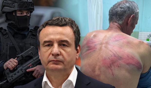 Kurti, prebijeni Nenad Rašković 