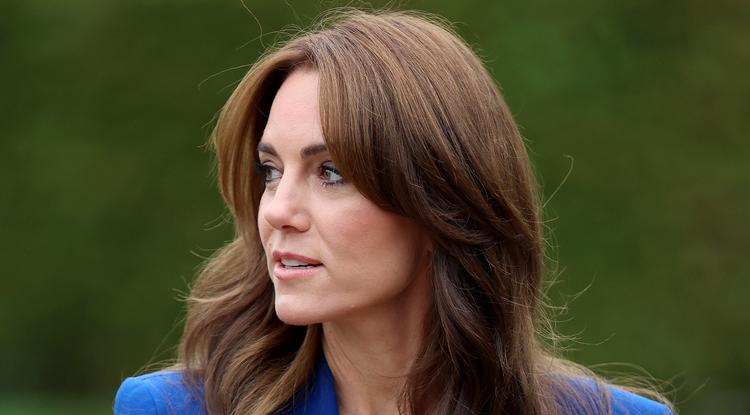 Emiatt kellett sürgősen megműteni Katalin hercegnét Fotó: Getty Images
