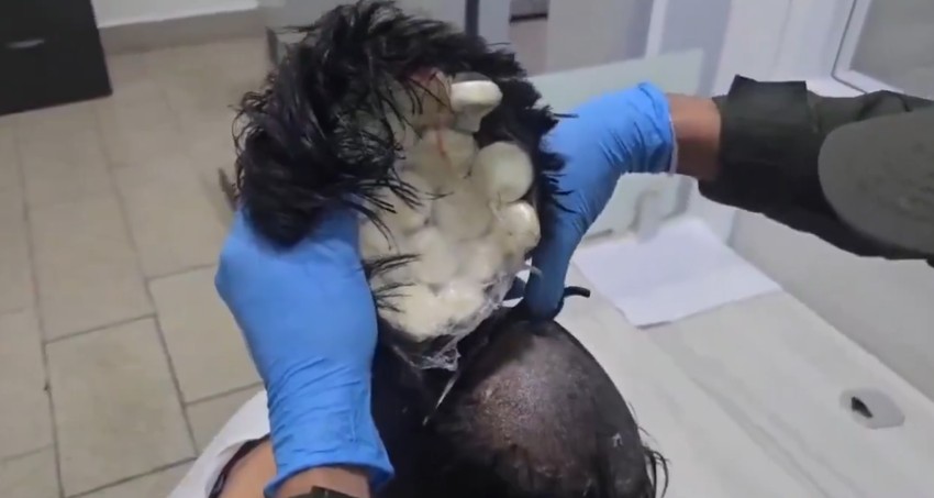 Skrivao kokain ispod perike 