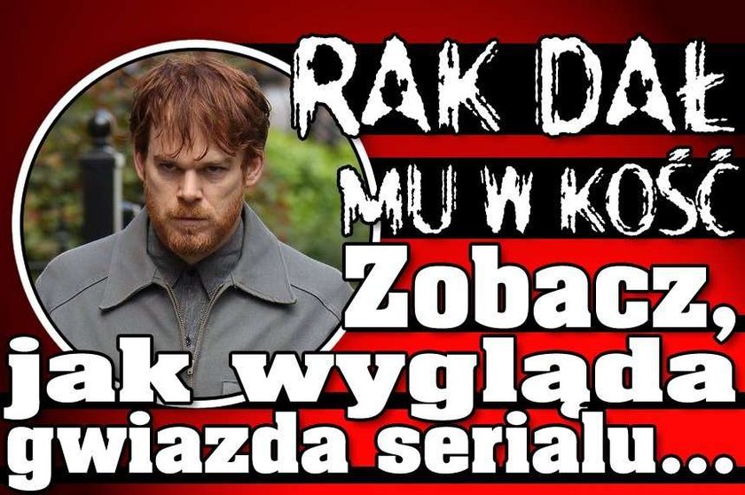 Rak dał mu w kość. Zobacz, jak wygląda gwiazda serialu "Dexter"