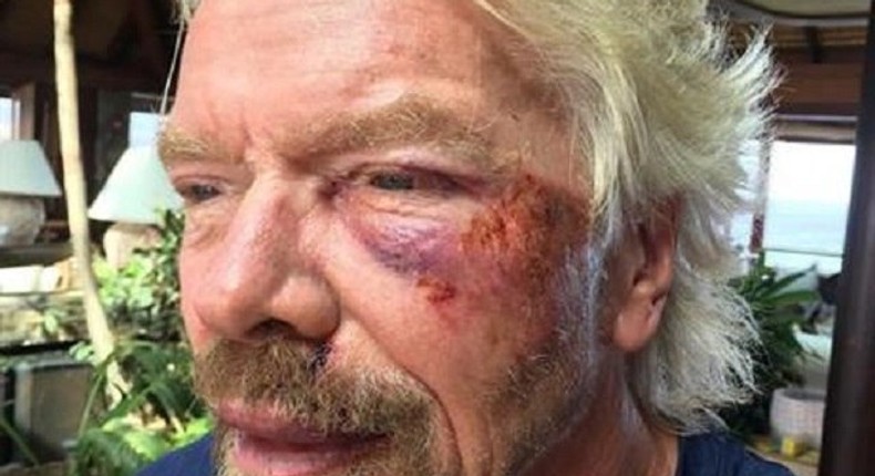 The injured billionaire tycoon, Richard Branson