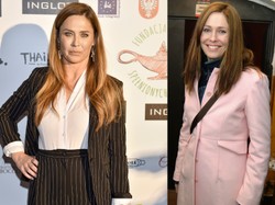 47-letnia Dorota Naruszewicz przyznała się do korzystania z botoksu. Czy to jej służy? FOTO