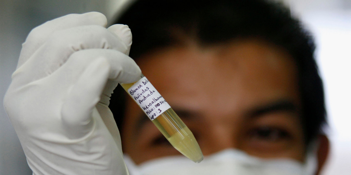 An epidemiologist examines the sample taken from a patient thought to be infected with influenza A (H1N1) virus.