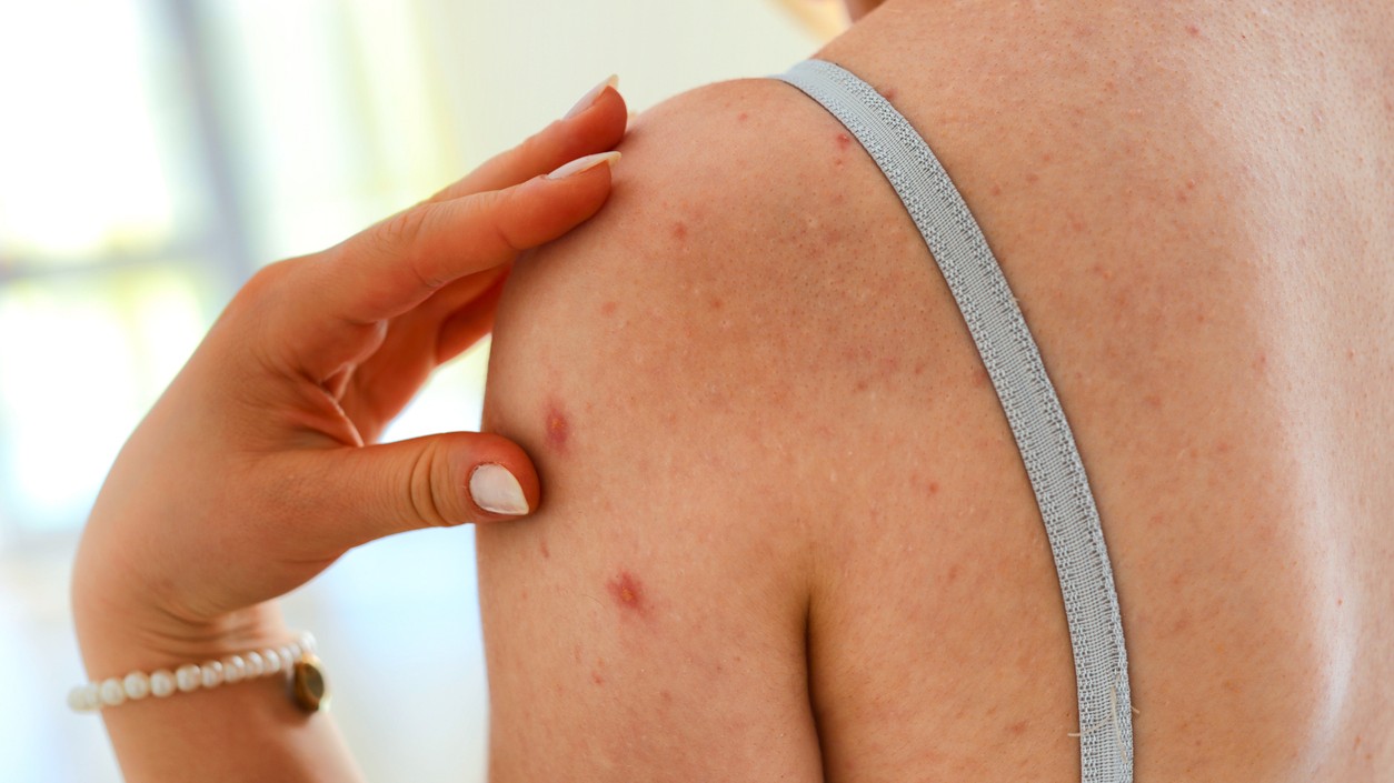 Bolestivé hrčky. (Ilustračná foto)