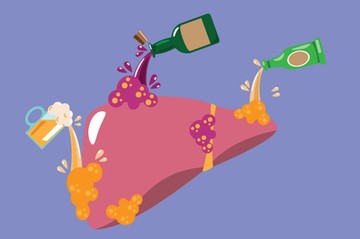 alkohol, májdaganat, májrák, zsírmáj