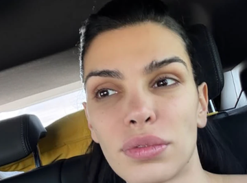 "IZVADIO MI JE MALTENE POLA NOSA" Manekenka otvoreno o NEUSPELIM estetskim zahvatima, skrenula pažnju mladim devojkama (FOTO) 