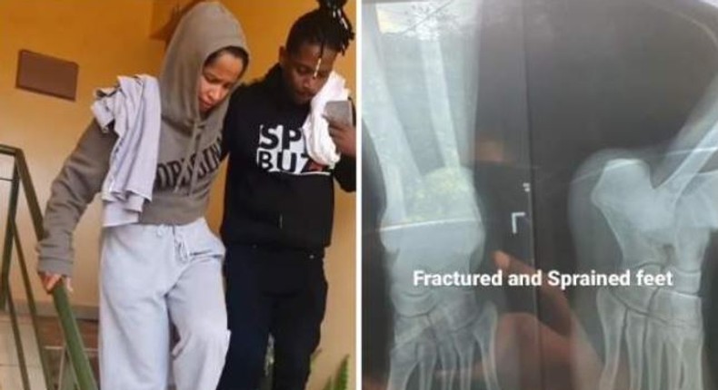 A collage image of Eric Omondi and Chantal and an X-Ray image shared by the comedian showing the injuries she sustained