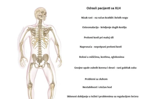 Osteomalacija NM-RS-2024-7-4074, Jul 2024