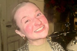 Ušla je u avion za Dubai, posle dva sata LICE JOJ JE GORELO OD CRVENILA: "Koža mi se raspadala i ljuštila sa celog tela, jedva sam PREŽIVELA, a evo šta je RAZLOG"