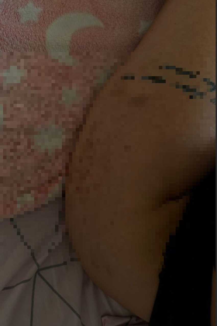 Aleksandrine modrice