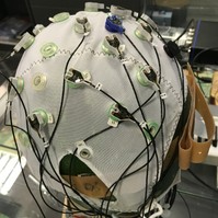 Agyi defibrillátor: megállíthatja az epilepsziás rohamokat
