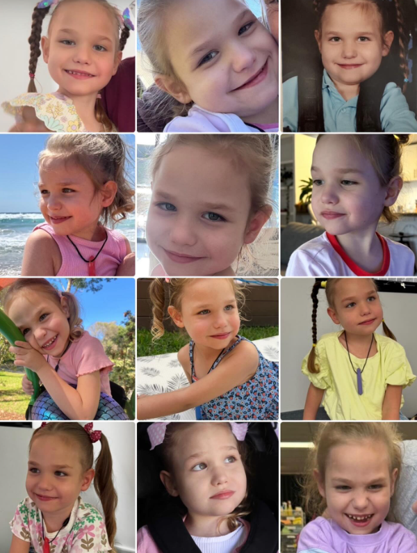 Luella Oudshoorn sa narodila so zriedkavou formou epilepsie.