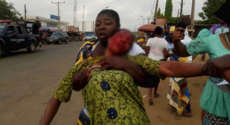 A woman helps another to walk after she was stabbed at a polling unit. [Channels TV]