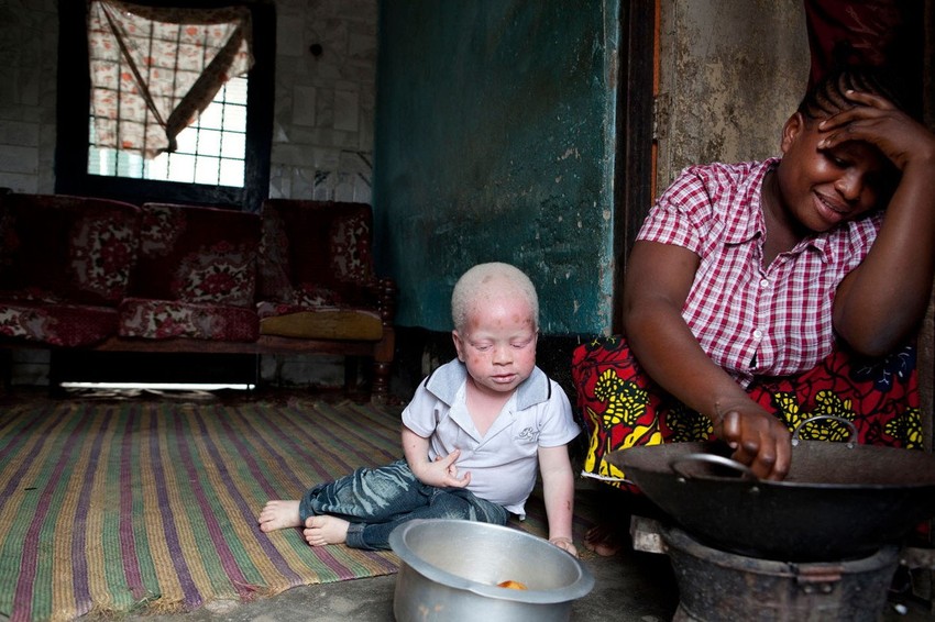 Konstantna meta trgovaca organima