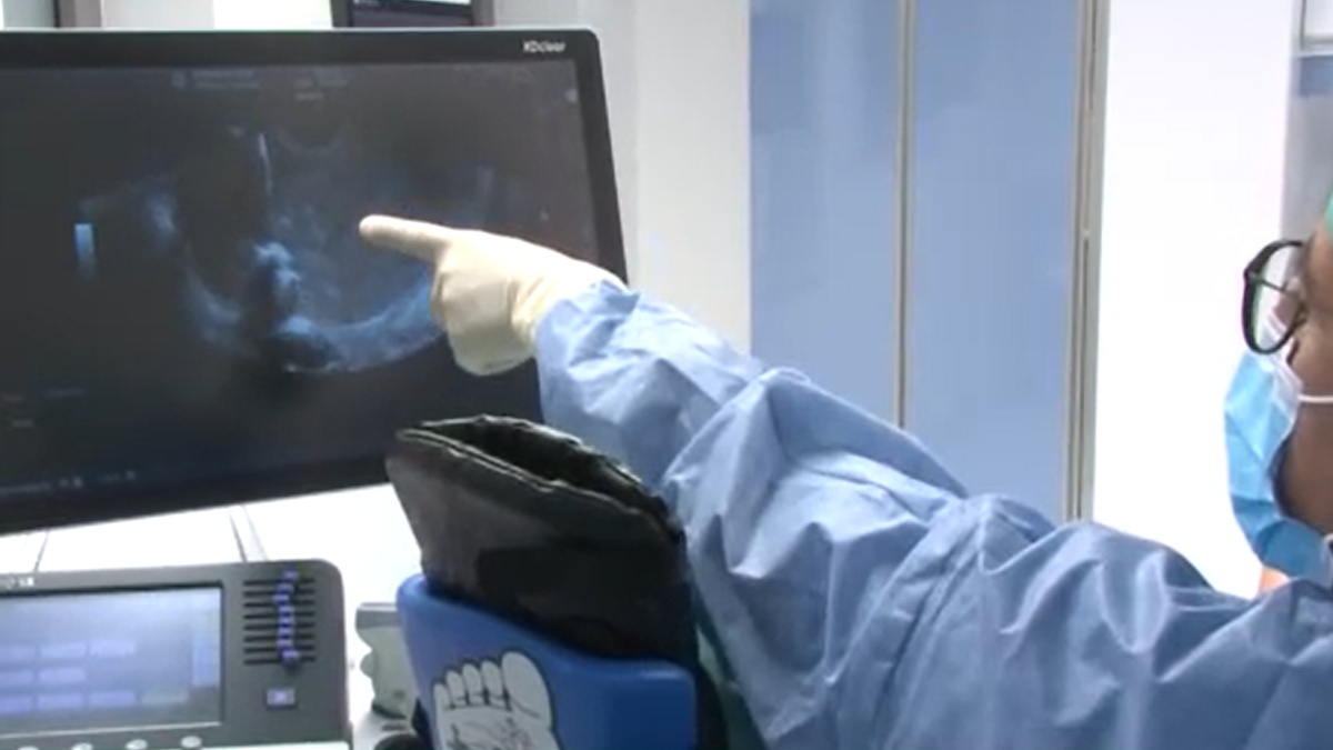 Orvosi csoda a Semmelweis Egyetem klinikáján: az édesanyja hasában altattak el egy magzatot egy életmentő műtéthez – videó