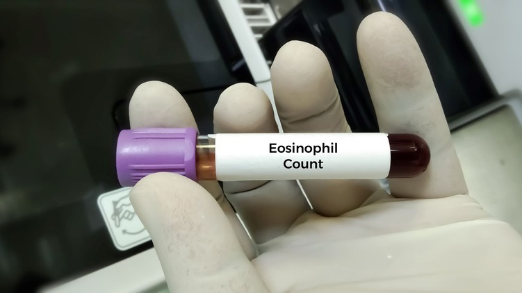vérvétel mitől magas a eosinophil