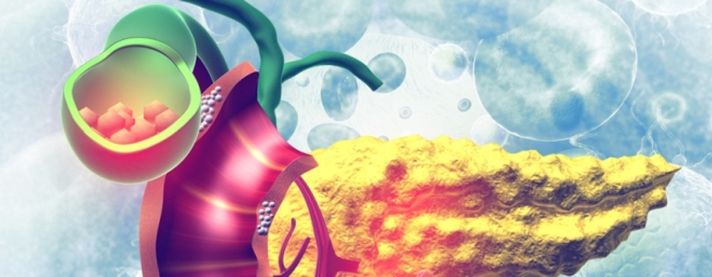 Ezek a hasnyálmirigyrák jelei, tünetei