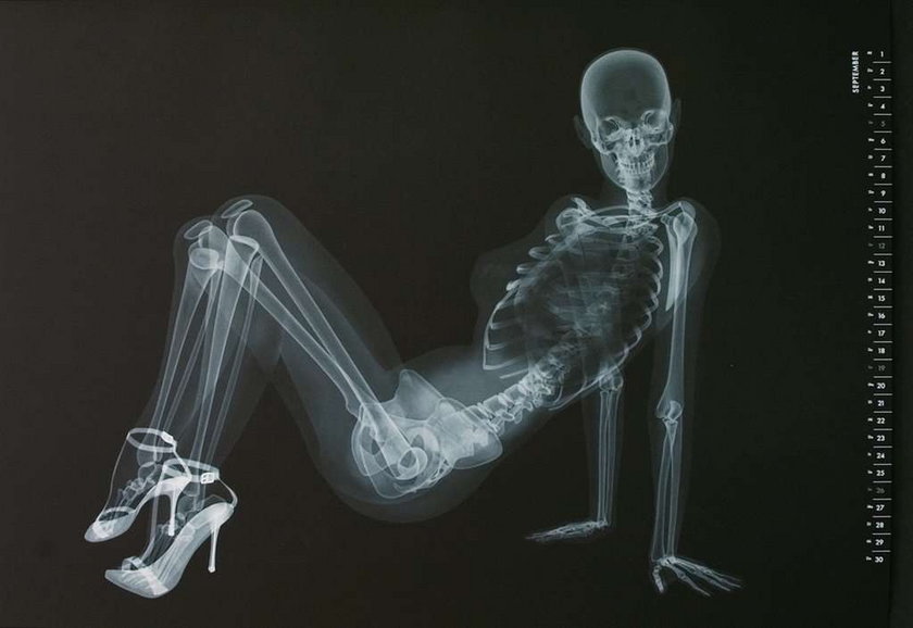 Seks na zdjęciach rentgenowskich! Szokujące?