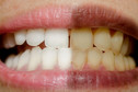 1. Wybielające pasty do zębów