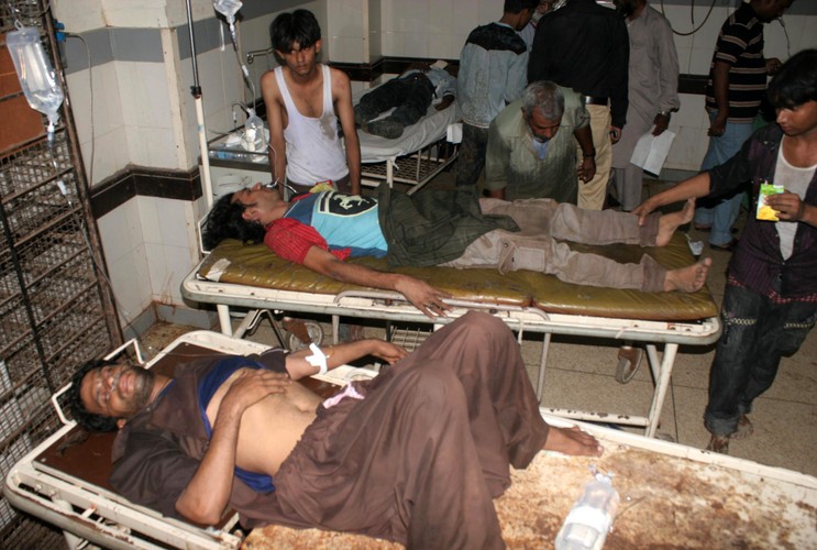 Poparzeni pracownicy