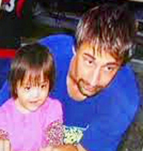 Dallas Wiens. Przeszedł przeszczep twarzy