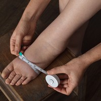 Vizesedik, felpüffedt a lába? Ekkor jelez nyiroködémát