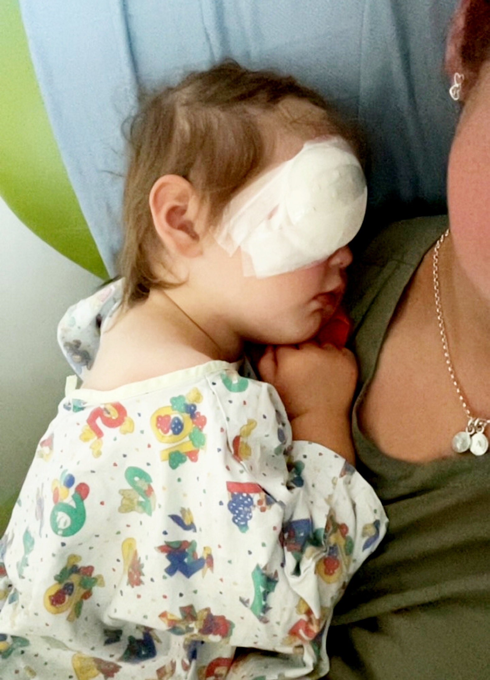 Dievčatku diagnostikovali retinoblastóm v pokročilom štádiu.