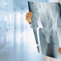 Csípőprotézis műtét után így lehet lerövidíteni a gyógyulási időt