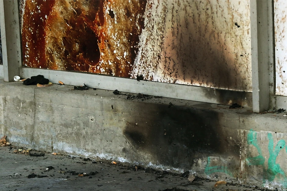 Preminuo je od teških opekotina