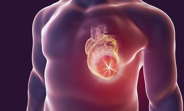 Ezek a szívinfarktus legveszélyesebb rizikófaktorai