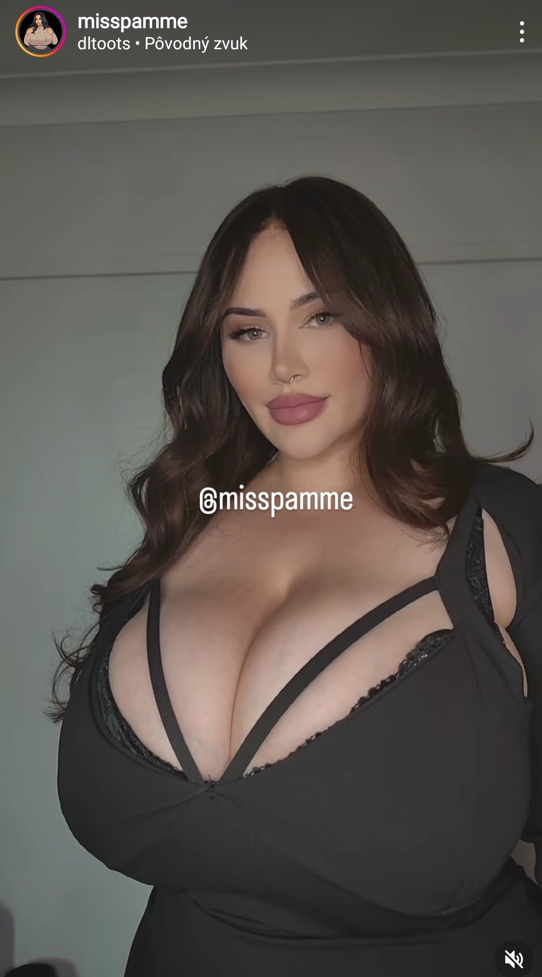 Pamelia James má diagnostikovanú gigantomastiu. Tá spôsobuje nadmerný rast prsníkov. 