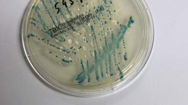Rośnie liczba ofiar bakterii EHEC