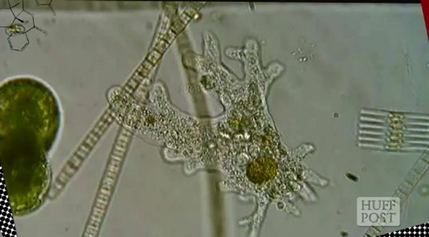 Drugi najčešći utrok smrti od parazita na svetu: Amebe