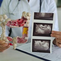 Ezekkel a vizsgálatokkal bizonyosodhat meg bélrendszere állapotáról