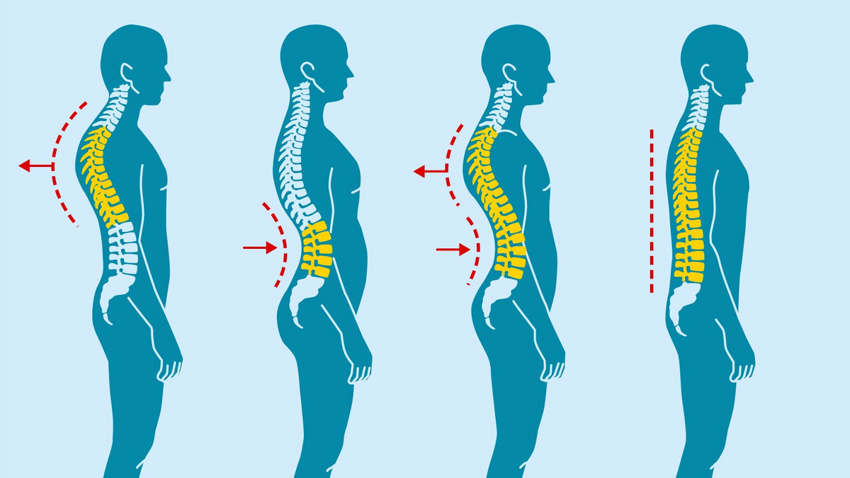 Boli cię kręgosłup? Sprawdź, jak o niego zadbać! INFOGRAFIKA