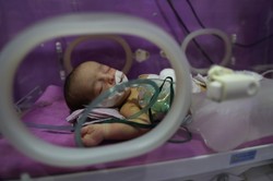 Noworodek wymagał pilnej operacji, mógł umrzeć. Lekarzom pomógł internet