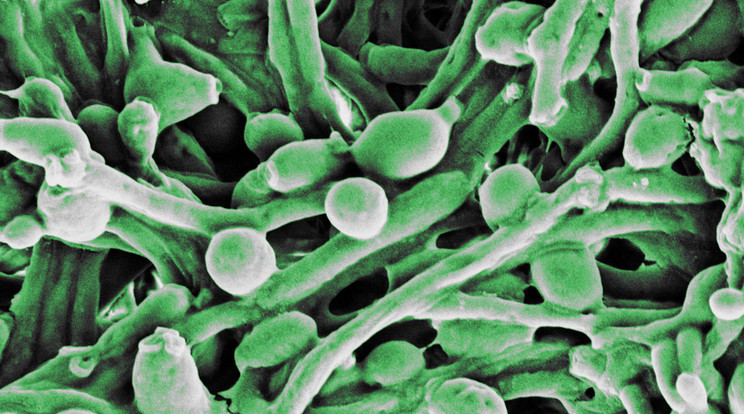 Sok milliárdnyi mikroorganizmus él rajtunk és bennünk, döntő többséggel a bélrendszerben. A bél mikrobiom össztömege akár a két kilogrammot is elérheti. Ennek három tizede elég hasonló fajon belül, de a hét tizede abszolút egyedi azonosító csakis ránk jellemző, mint az ujjlenyomat. Ez a magyarázata, hogya súlyos megbetegedések során másként hatnak ránk ezek a mikrobák. Egy gombafaj, a Candida albicans biztosan, hogy nem tétlenkedik, ha a gyengeségünket megérzi. / Fotó: Wikipedia