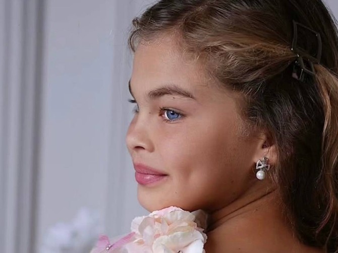 Prošlog leta ova devojčica (9) bila je beskućnica, a sada je uspešna manekenka