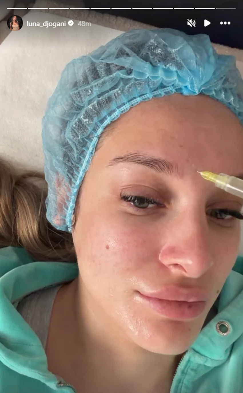 Luna Đogani otišla na podmlađivanje lica, snimila ceo proces kod kozmetičara