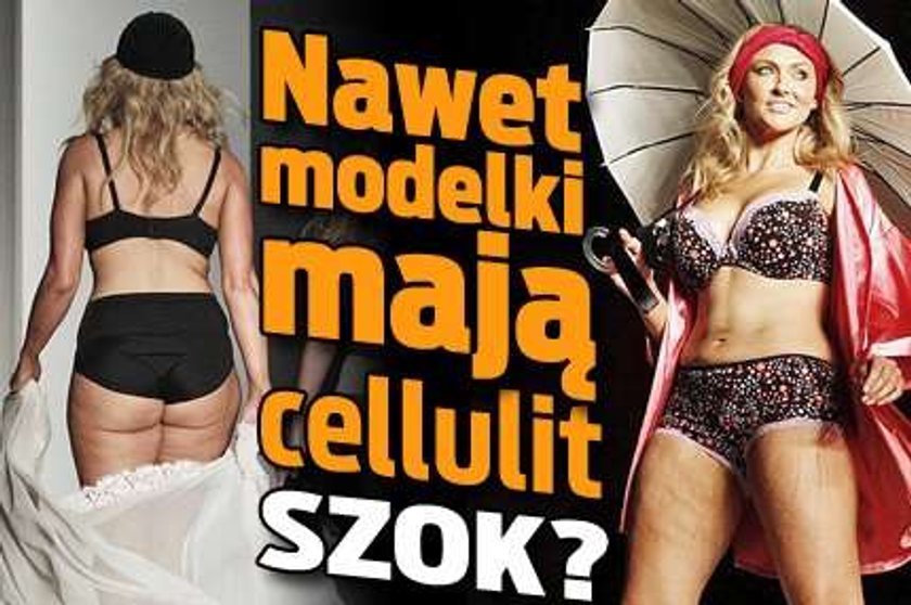 Nawet modelki mają cellulit. Szok?