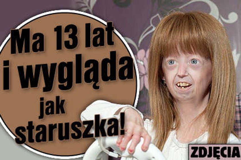 Ma 13 lat, a wygląda jak staruszka