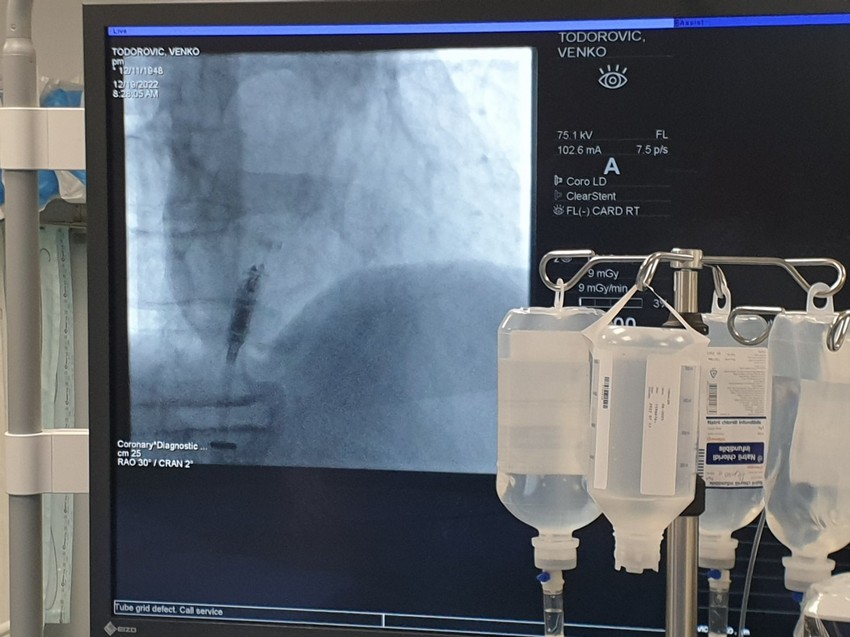 Prvi mikro pejsmejker ugrađen u UKC NIš
