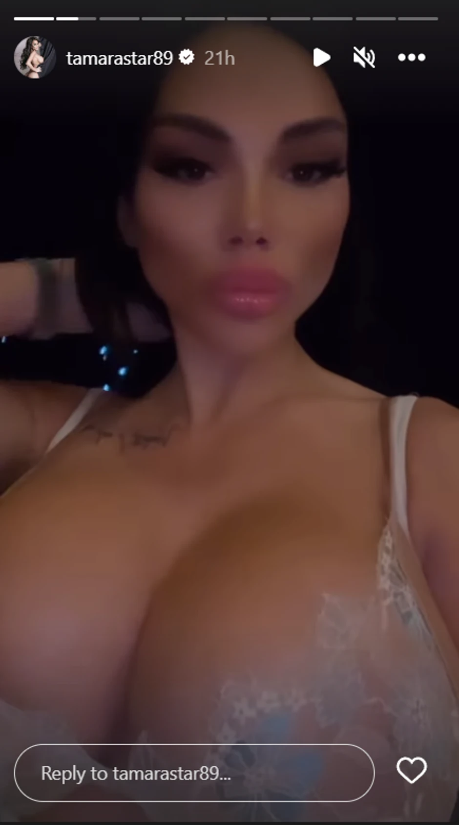 Ogromni silikoni Tamare Đurić