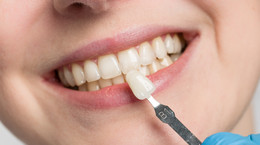 Na ile zębów zakłada się licówki? Dentystka wyjaśnia