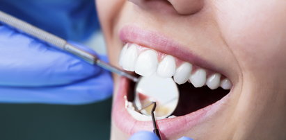NFZ przestanie płacić za dentystów?
