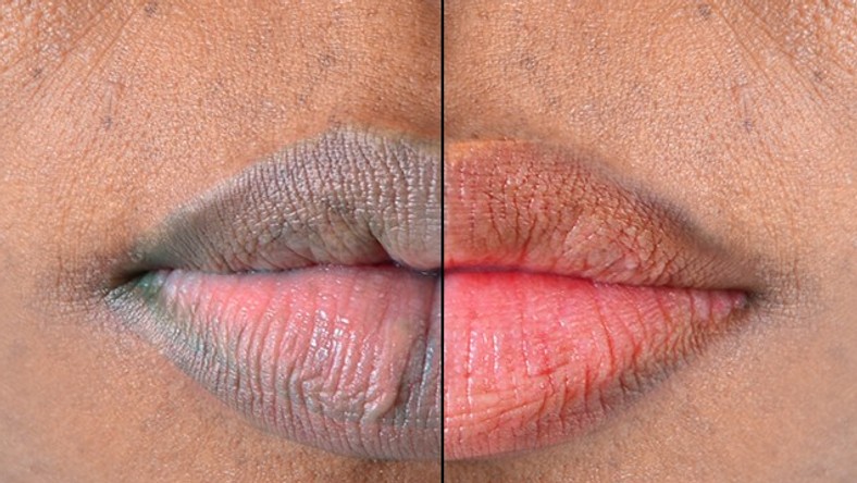 Lips: Here are 5 naturally ways to make them soft and pink [Medium] 
