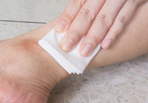 Zaustavljanje krvarenja