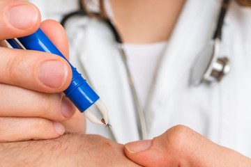 Kullancs kiszedése csipesszel, kanállal: így szedheti ki jól az élősködőt